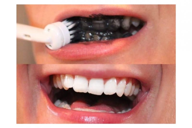 enamel toothpaste before and after